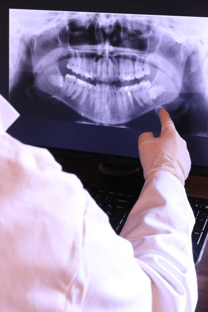 Best Emergency Tooth Extraction in Foxfire, NC
