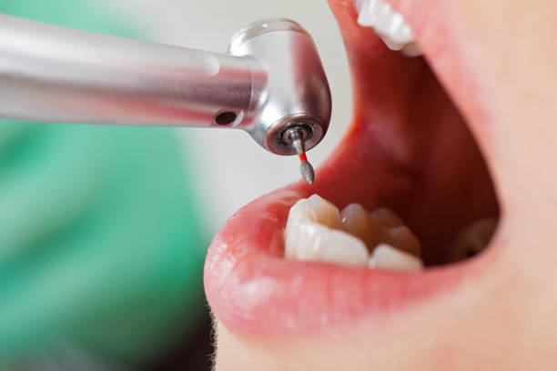 Best Emergency Gum Treatment in Foxfire, NC